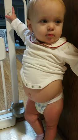 Aurora and her "Buddha belly."